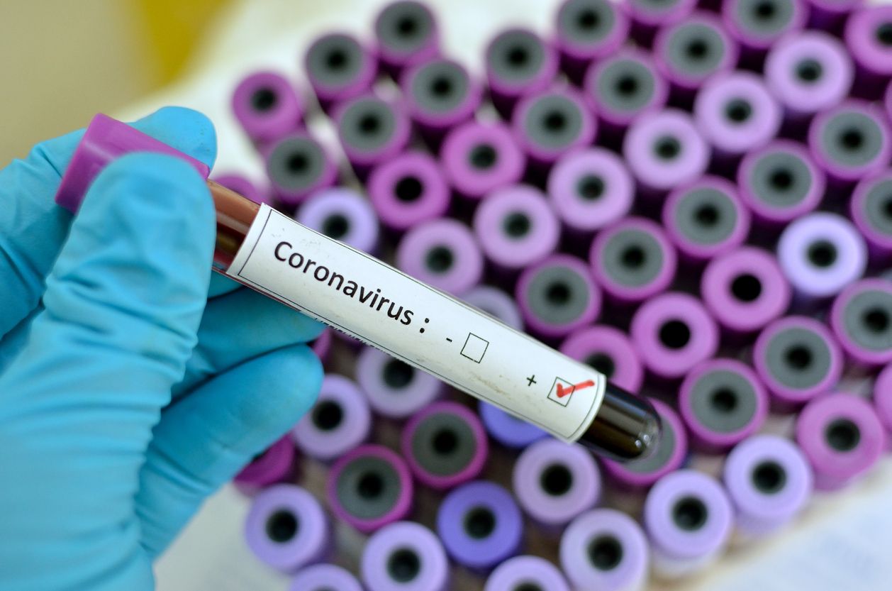 L'empresa catalana crea un 'kit' de diagnòstic capaç de detectar fins a 20 virus diferents | iStock